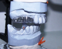 Усовершенствованный интегрированный подход к планированию и проведению стоматологического лечения с использованием дентальных имплантатов 14. 01. 14 Стоматология (мед науки) preview 1