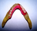Усовершенствованный интегрированный подход к планированию и проведению стоматологического лечения с использованием дентальных имплантатов 14. 01. 14 Стоматология (мед науки) preview 4