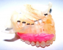 Усовершенствованный интегрированный подход к планированию и проведению стоматологического лечения с использованием дентальных имплантатов 14. 01. 14 Стоматология (мед науки) preview 5