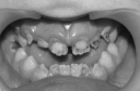 Ортодонтия и детское протезирование preview 5
