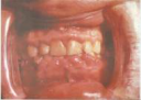 Рабочая программа терапевтическая стоматология и физиотерапия стоматологических заболеваний 060201 «Стоматология» preview 4