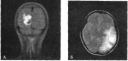 I. физиология головного мозга человека 12 preview 5