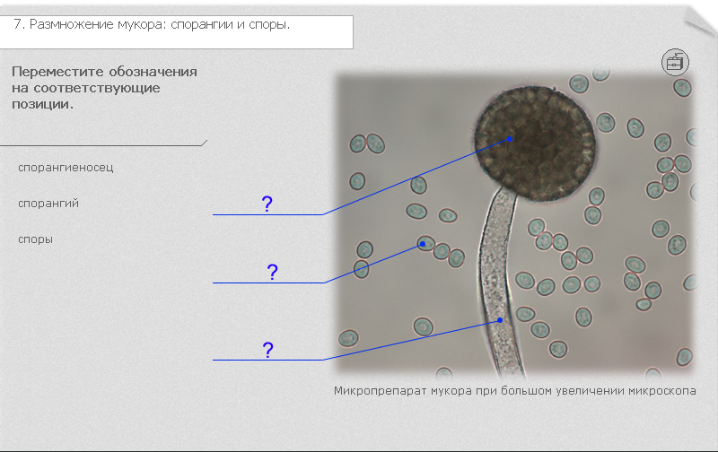 Мукор клетка. Плесень мукора под микроскопом с подписями. Клетка плесени мукора. Клетка гриба мукора. Клетка гриба мукора под микроскопом.